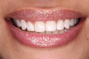 odontología estética de sonrisas