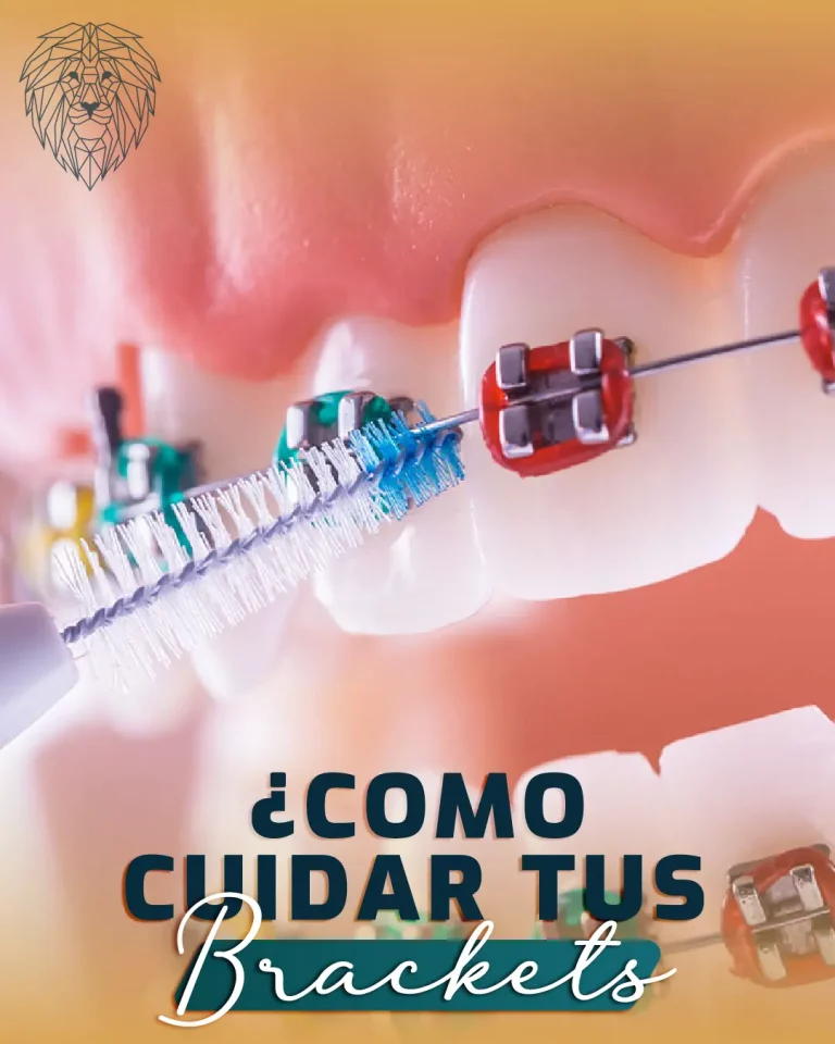 blog post cuidado ortodoncia