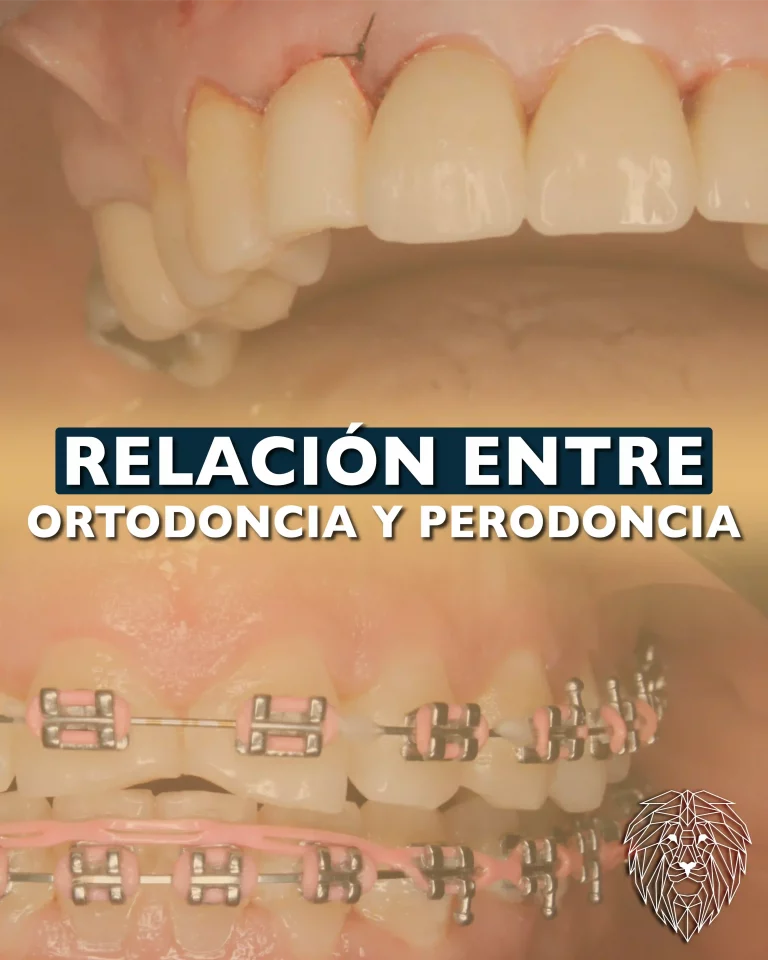 post blog relacion entre la ortodoncia y la periodoncia