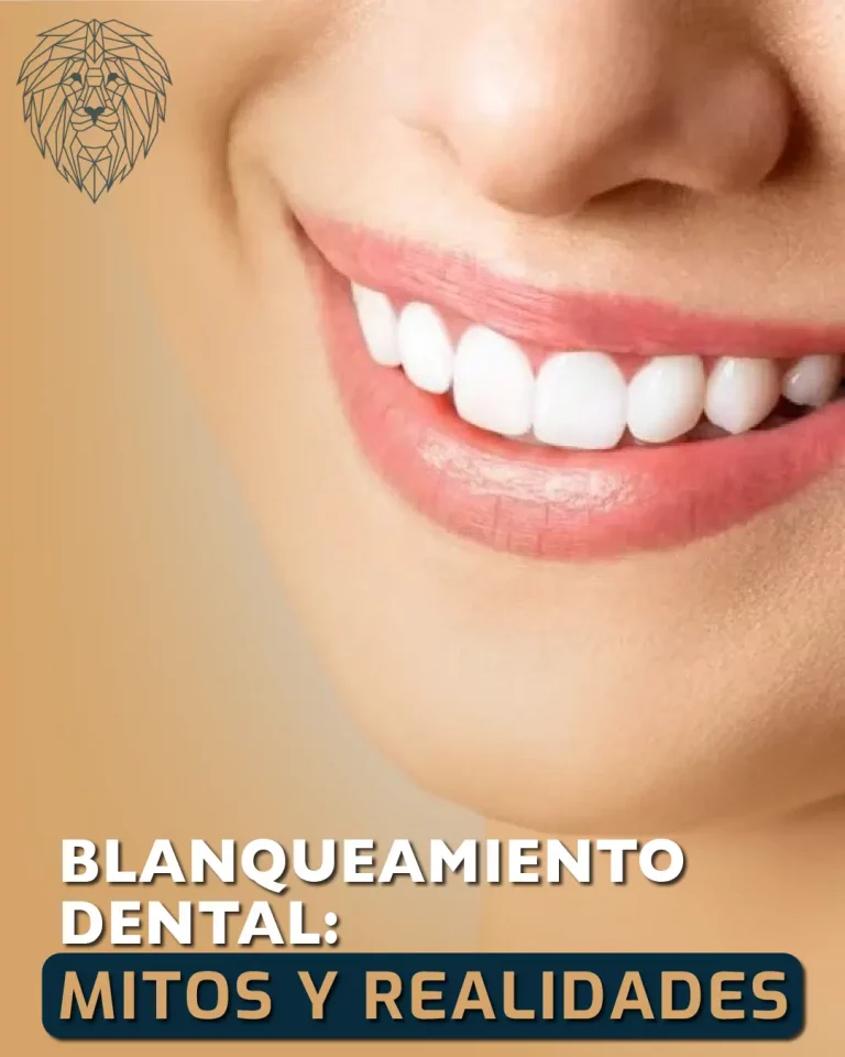 post de blog de los mitos del blanqueamiento dental